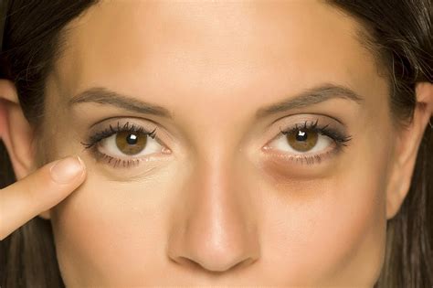 how to fake bags under eyes|minimize bags under eyes.